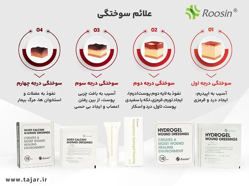 علائم سوختگی
